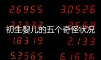 初生婴儿的五个奇怪状况